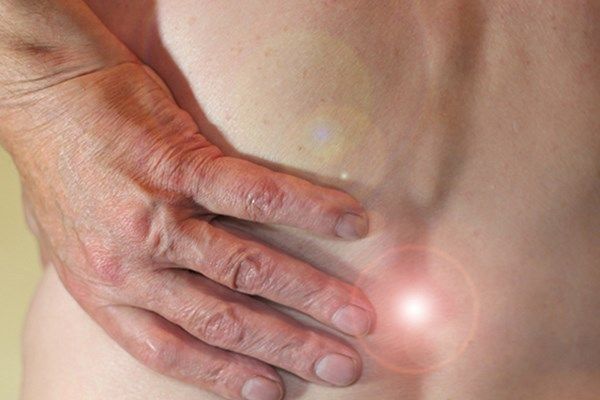 ¿Qué es la Lumbociatalgía? Explicado por Dr Guido Pugliese
