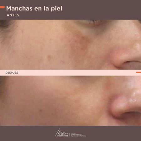 Manchas