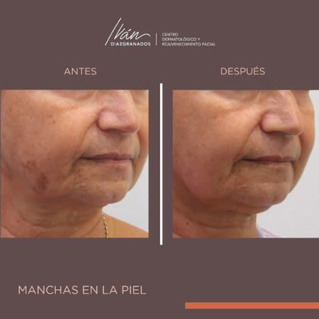 Manchas