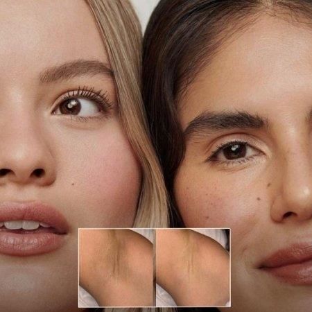 Peeling para aclarar zonas oscuras