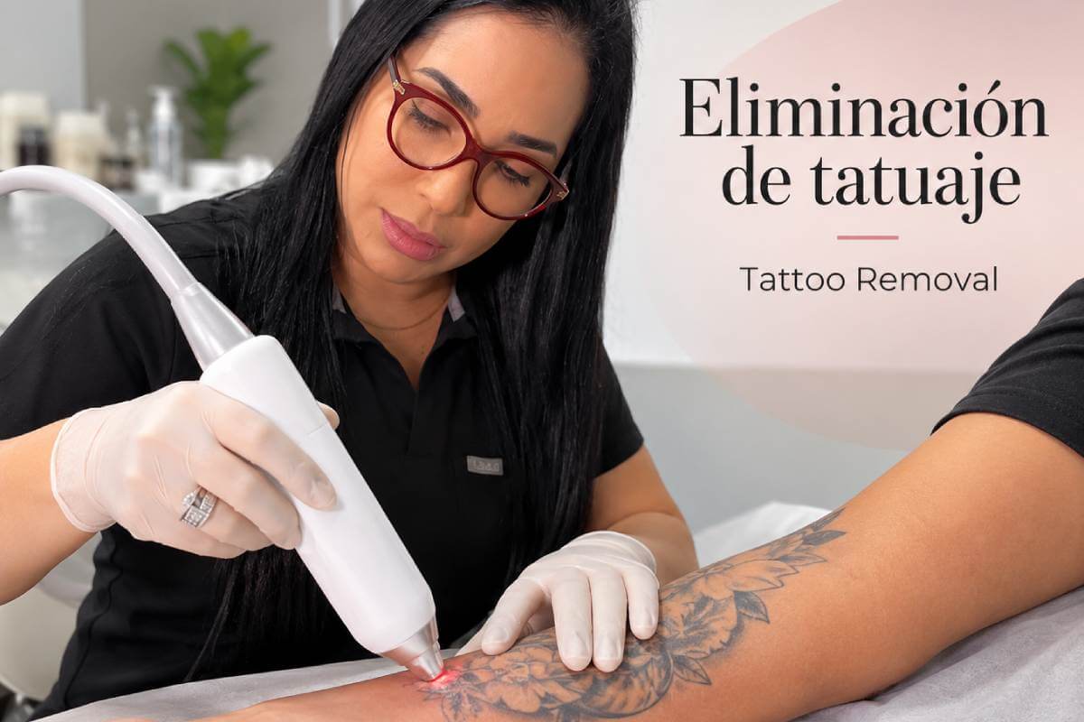 Eliminación de tatuajes en Barranquilla con láser: tecnología y atención especializada